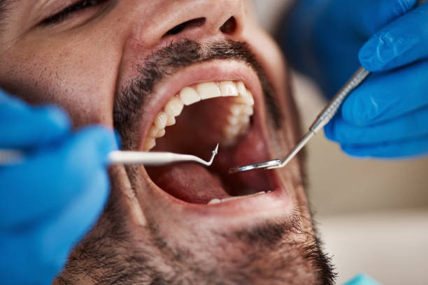 Best Broken or Chipped Tooth Repair in Skyline Acres, OH